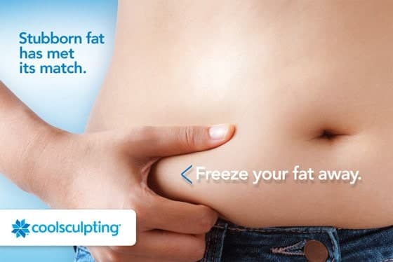 Coolsculpting of cryo lipolyse - de nieuwe trend in figuurcorrectie?