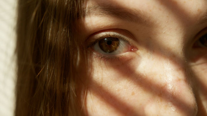 Last van couperose of rosacea? Deze natuurlijke middeltjes helpen!