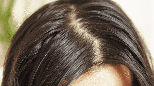 5 stappen voor minder vettig haar en haaruitval