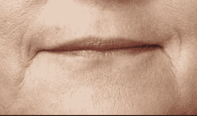 dunne lippen Afbeelding