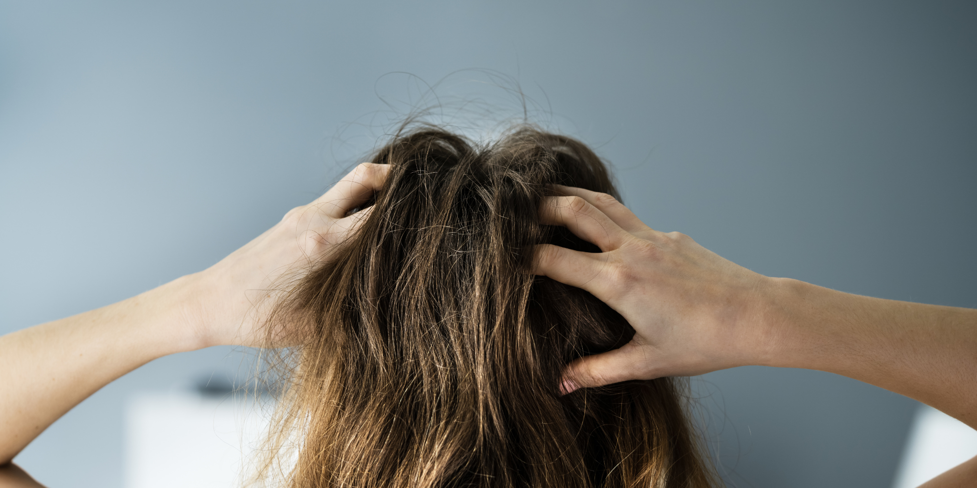 vrouw die in haar haren krabt omwille van een droge hoofdhuid Afbeelding