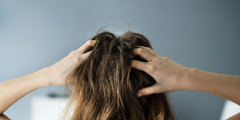 Oorzaken van een droge hoofdhuid