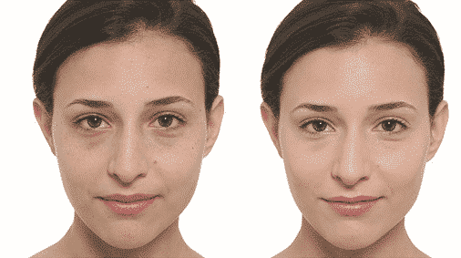 Hoe kan je pigmentvlekken camoufleren met make-up?