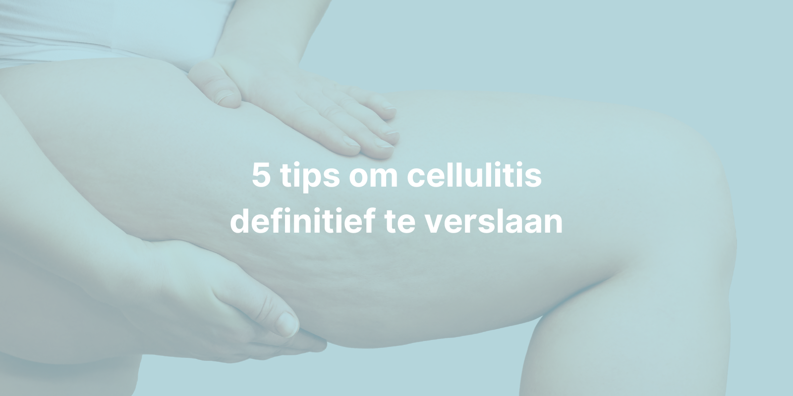 vrouw met cellulitis aan de bovenbenen Afbeelding