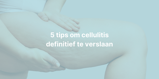 vrouw met cellulitis aan de bovenbenen