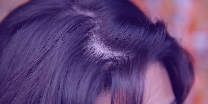 10 (natuurlijke) tips tegen vet haar