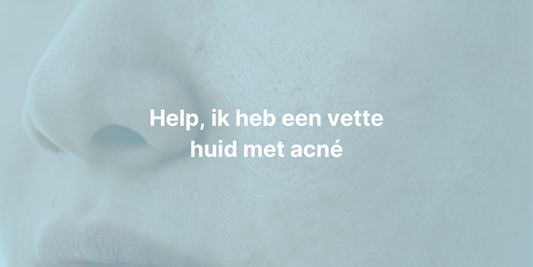 een closeup van een gezicht van een vrouw met acné en een vette huid