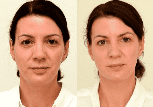 3 weken lang - 3 liter water per dag = mooie huid!