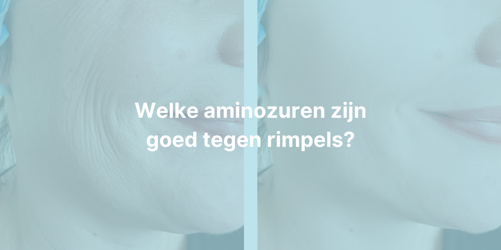 45+ vrouw met rimpels in het gezicht, voor en na Afbeelding