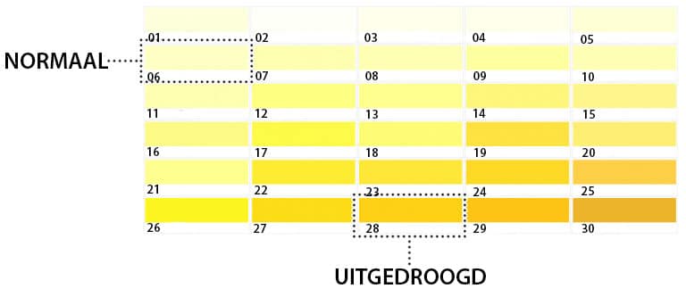 Hoe vaak per dag ‘moet’ je eigenlijk gaan plassen? – Mooi Verouderen